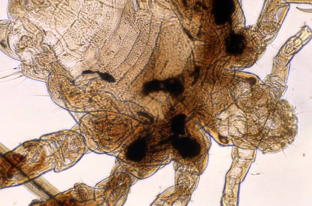 que son las ladillas, ladilla